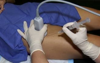 ecografía abdominopélvica