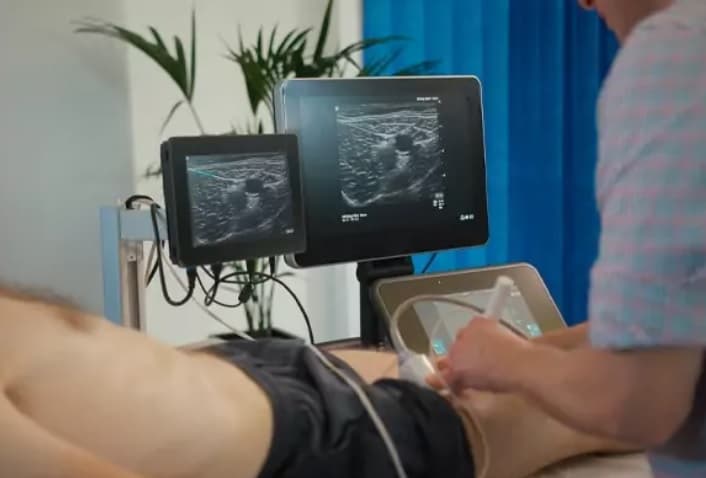 ecografía abdominopélvica